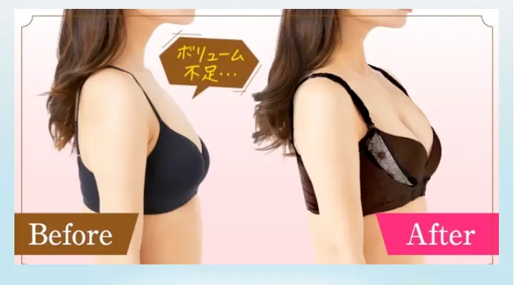 ロザブルー　ビフォーアフター