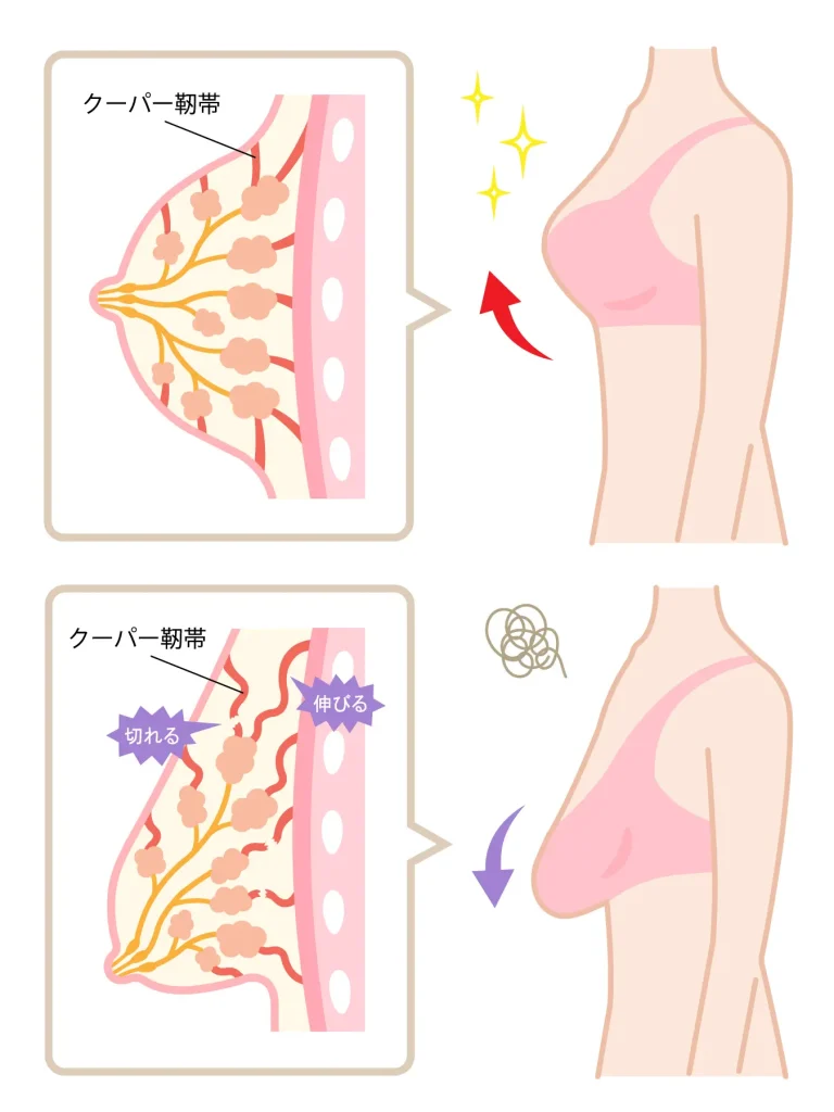 40代から始まるバストの悩みとストレス